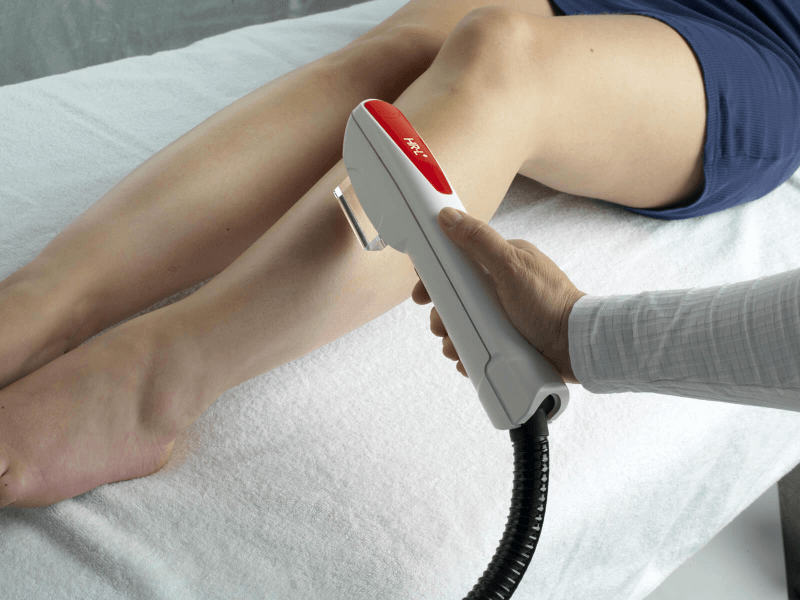 Laser Hair Removal Ellipse IPL